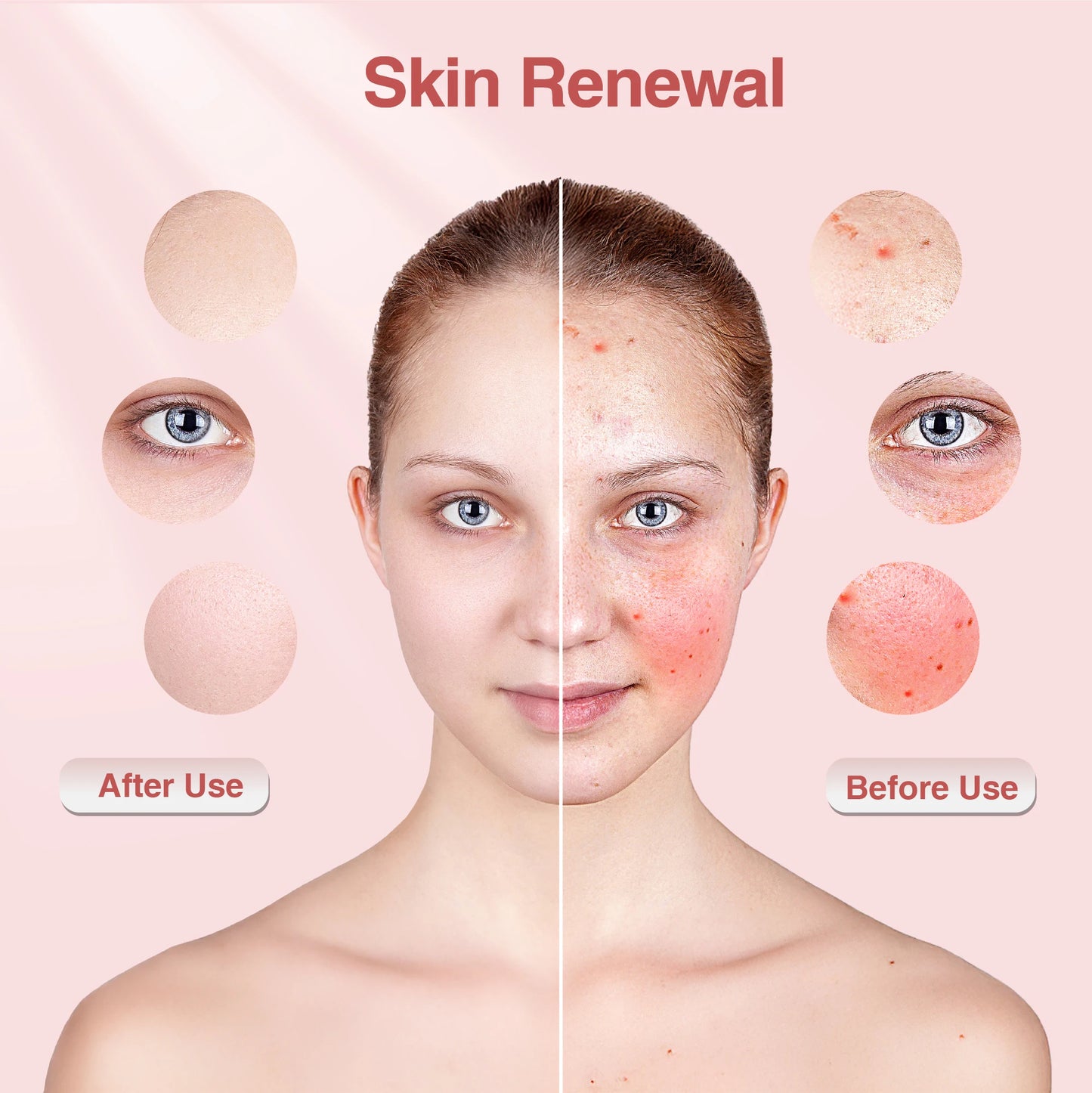 Raudonos šviesos terapinė fotonų kaukė Hello Face M500S LED 630nm 850nm artimos infraraudonosios šviesos terapinė veido kaukė Profesionali grožio priežiūra